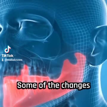 Most babies are being born witout a wisdom tooth