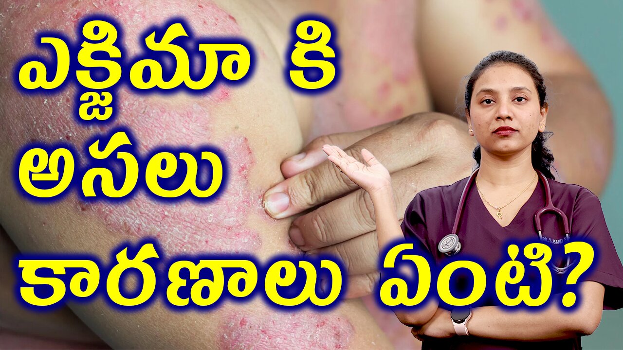 ఎక్జిమా కి అసలు కారణాలు ఏంటి? Causes and Riskfactors of Eczema Treatment Cure | హోమియోపతి