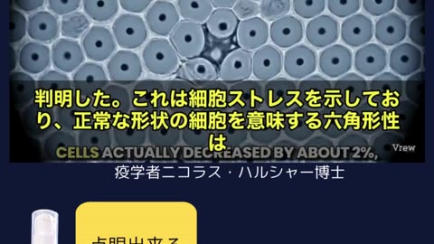 視界のぼやけ、視力低下の原因は❗️