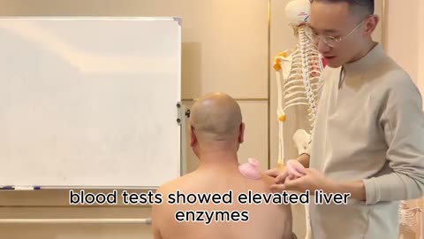 He Had Severe Fatty Liver Disease—Despite Never Drinking Alcohol