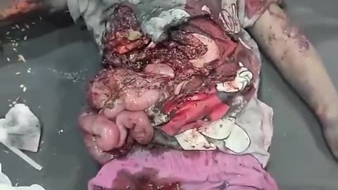 What Israel is doing to the children of Gaza..