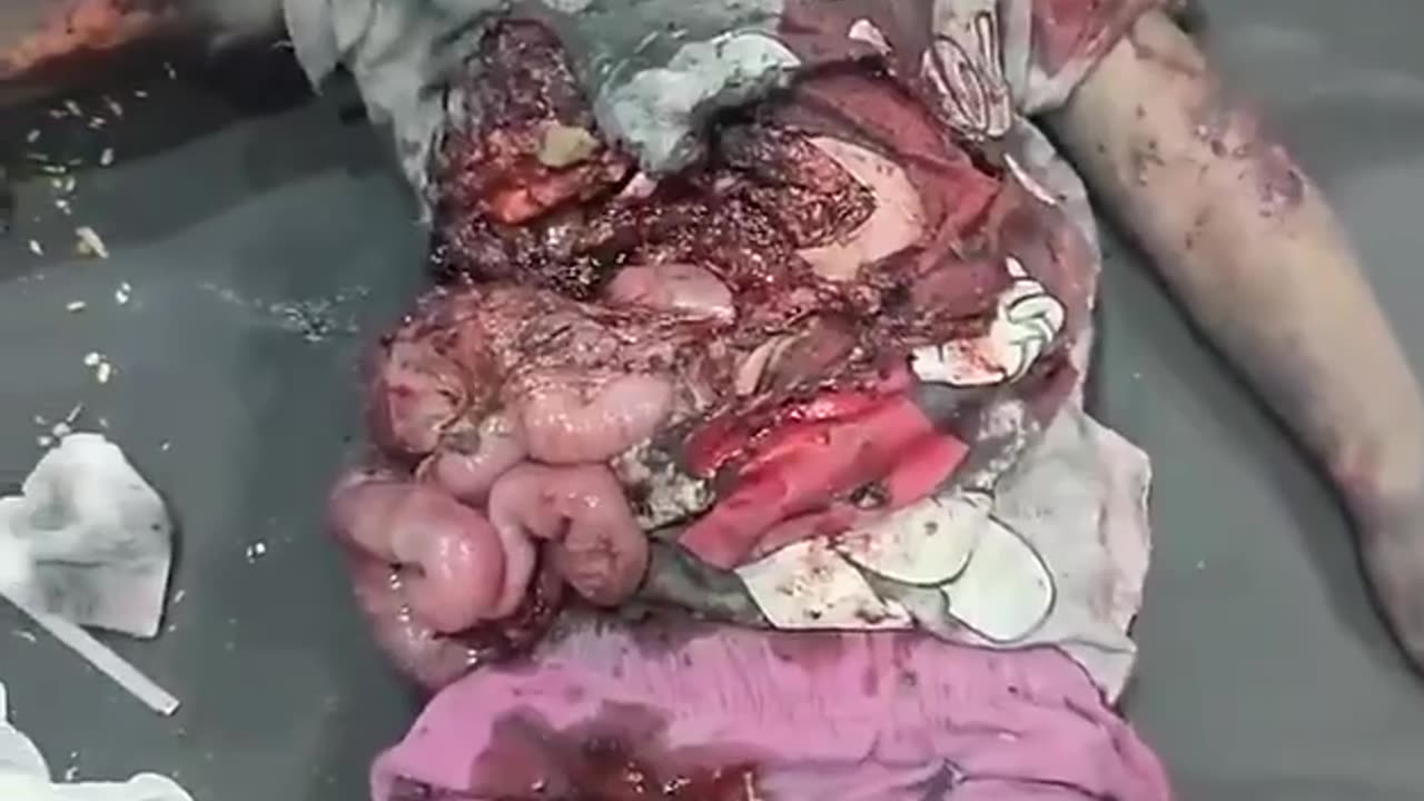 What Israel is doing to the children of Gaza..