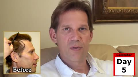 Dr. Brett Bolton: Expert Hair Consultant Undergoes Hair Transplant Surgery