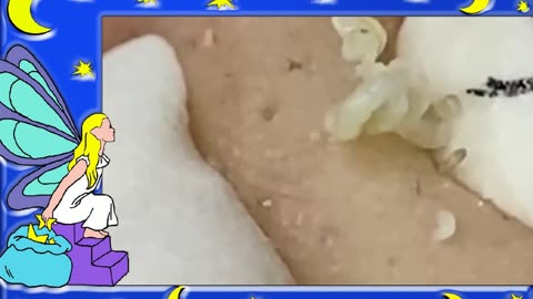 *Eels: Resistance was futile*💕