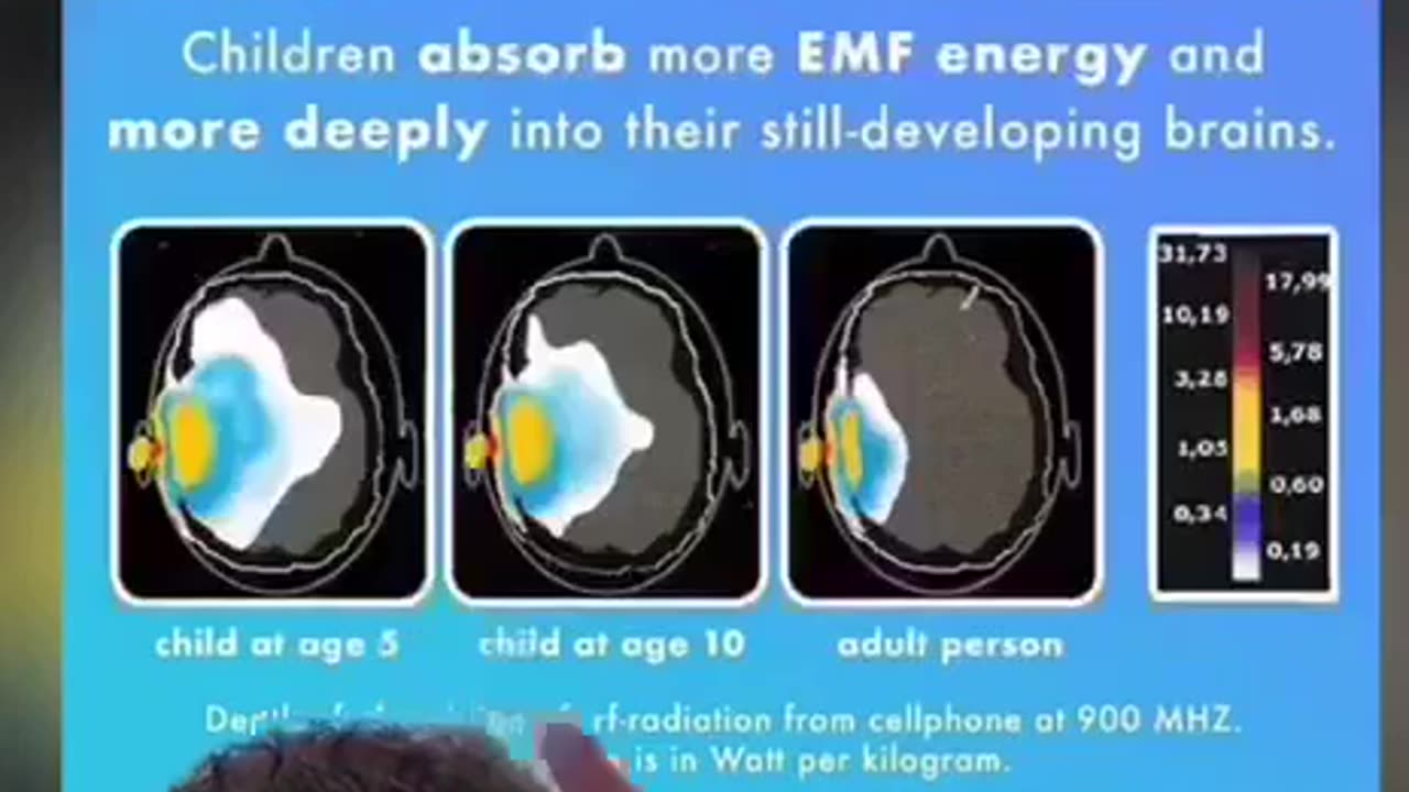 Wearing AirPods will lower male testosterone levels