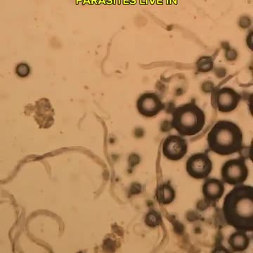 Baking soda versus parasites (Read Description)