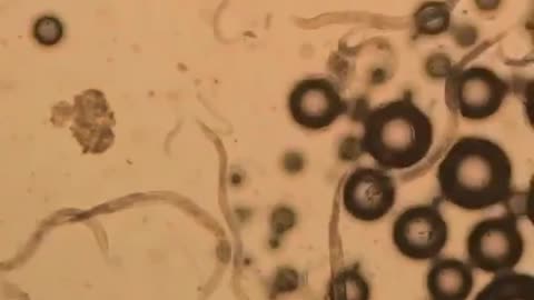 Baking soda versus parasites (Read Description)