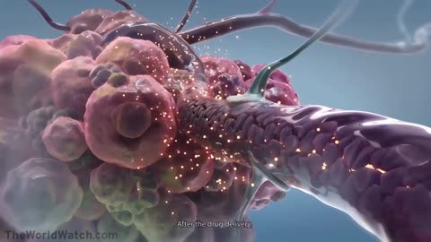 Mel Gibson isn't lying… A recent study documented COMPLETE REMISSION of Stage IV canc