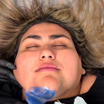 Full Face Waxing Demo by @modalityesthetics Using Sexy Smooth Sexy Sapphire Hard Wax