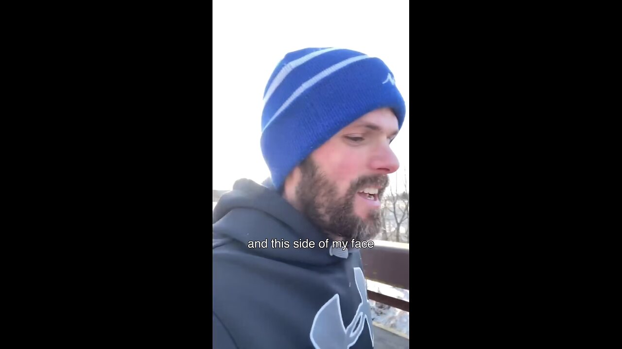 Half My Face Is Frozen