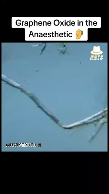 All dental anesthetics now seem to have graphene oxide in them, as tested by many independent labs l