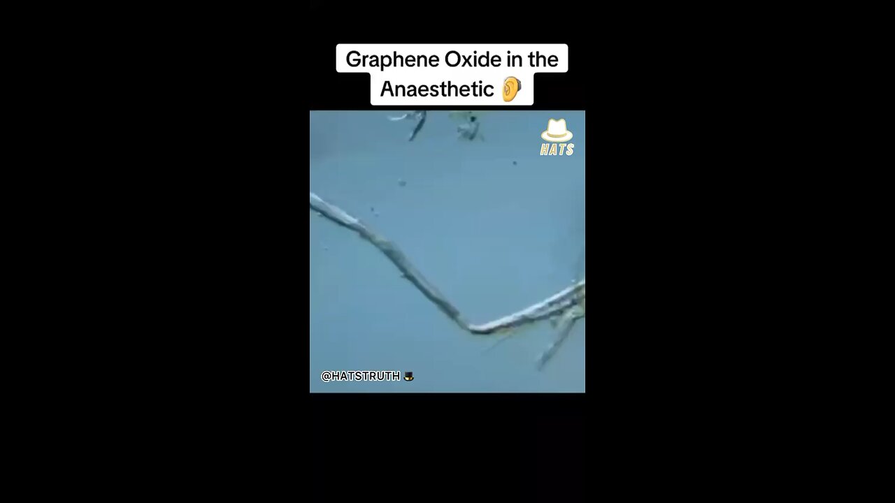 All dental anesthetics now seem to have graphene oxide in them, as tested by many independent labs l