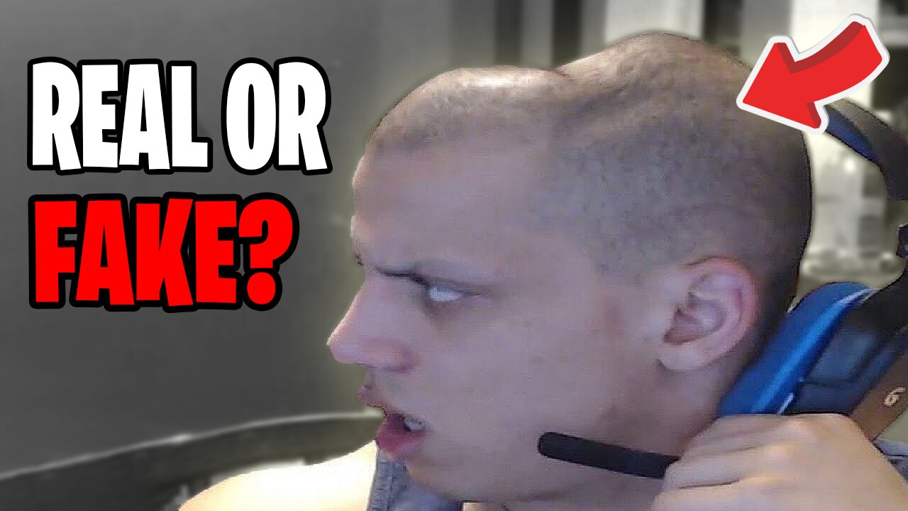 Is Your Gaming Headset Damaging Your Head?