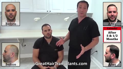 Dr. Brett Bolton Showcases Adrien’s MaxHarvest™ Plus Hair Restoration Timeline