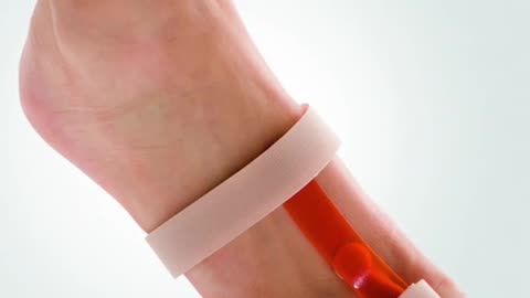 Hammer Toe Repair Surgery 3D Animation