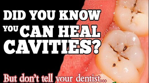 You Can Heal Cavities In A Natural Way Without Going to the Dentist with THIS!