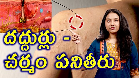 దద్దుర్లు చర్మం పనితీరు Structure and Fucntion of Skin in Urticaria Hives or wheals | హోమియోపతి