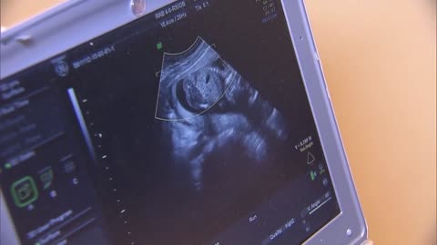 Trump administration proposes using tariff money to fund WIC