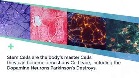 Could stem cell therapy be the key to unlocking a cure for Parkinson's disease?