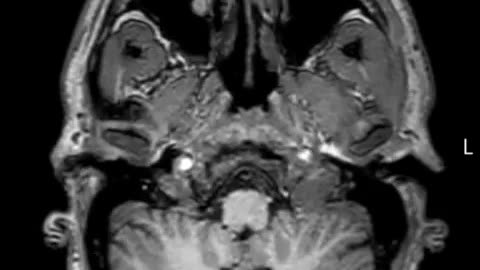 🤯✨ Jaw-Dropping MRI of My Head From Bottom to Top! | FeedMyCuriosity