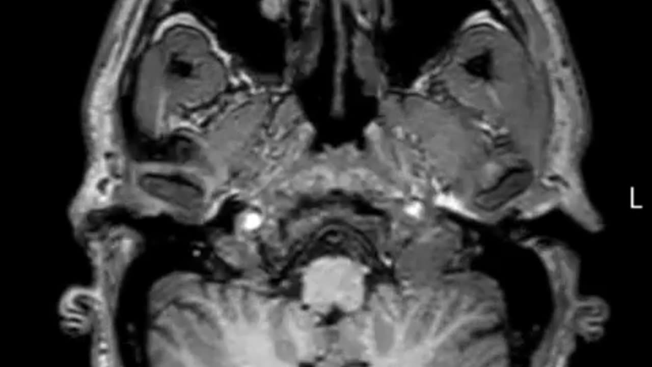 🤯✨ Jaw-Dropping MRI of My Head From Bottom to Top! | FeedMyCuriosity