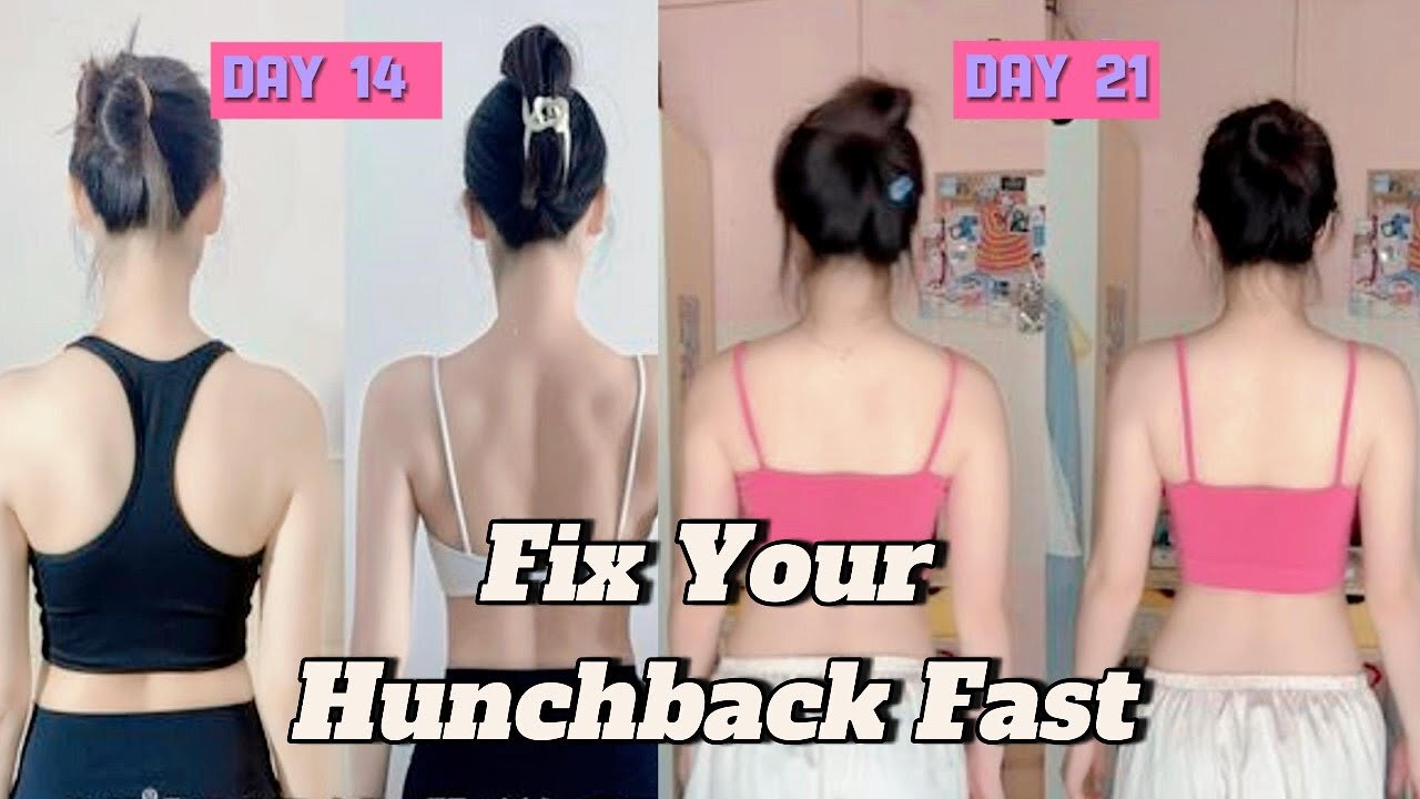🔥 7-Min Anti-Hunch Workout | Correct Neck & Upper Back Posture Fast at Home