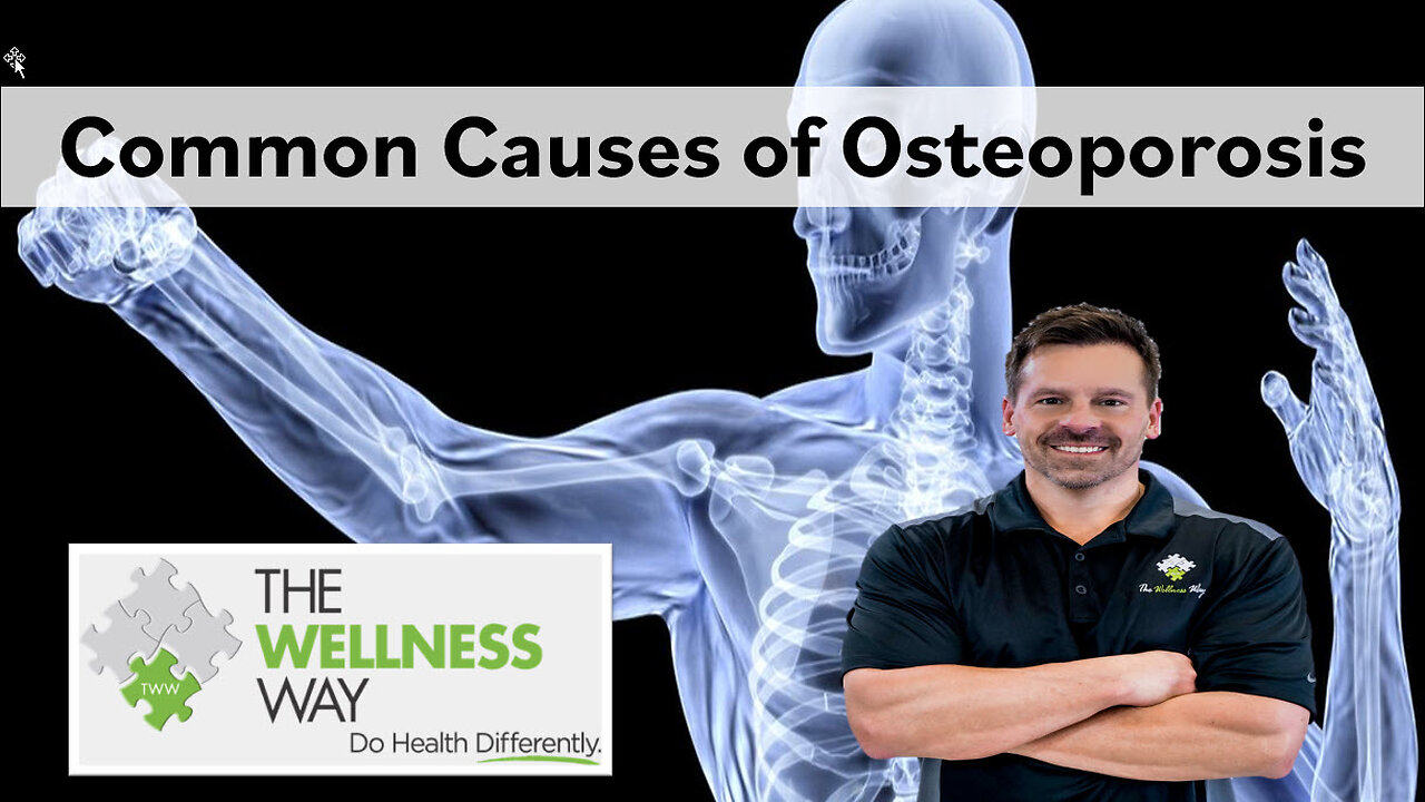 🦴 Common Causes of Osteoporosis 🦴