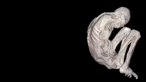 🤯👽 Montserrat's Pregnancy Reveal: Using Her Own DICOM File! | TheTruthAbove
