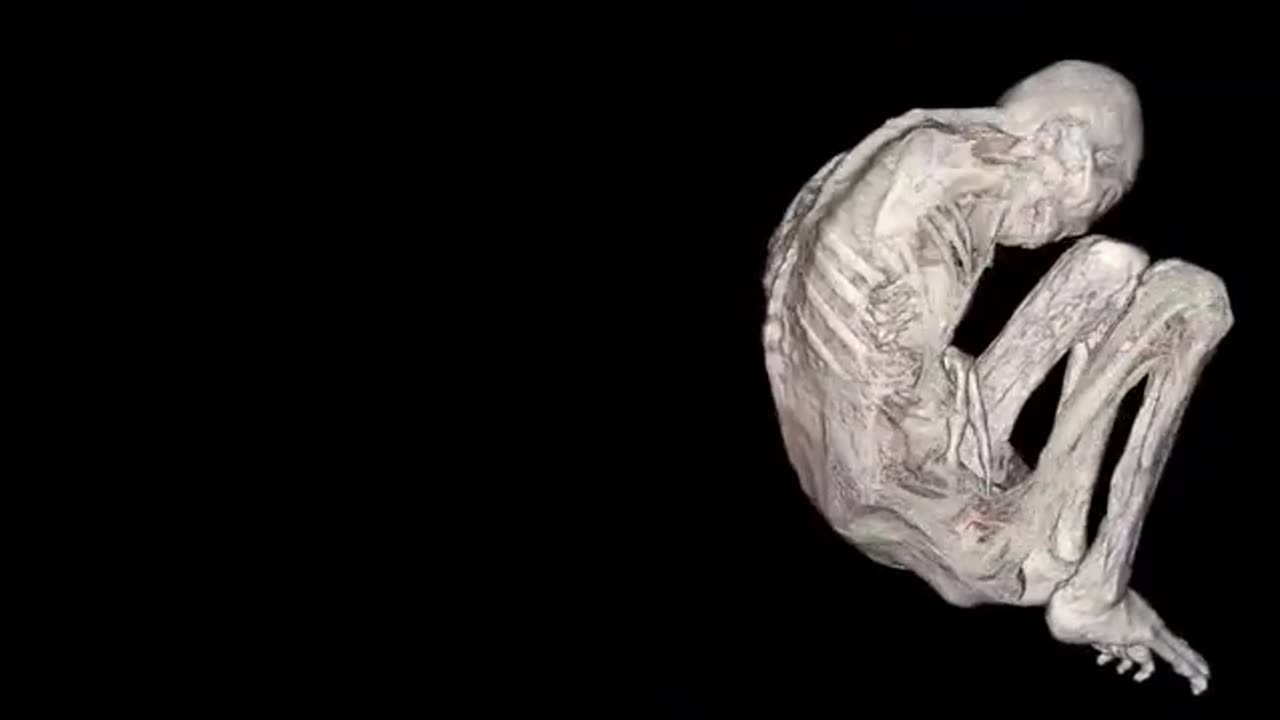 🤯👽 Montserrat's Pregnancy Reveal: Using Her Own DICOM File! | TheTruthAbove