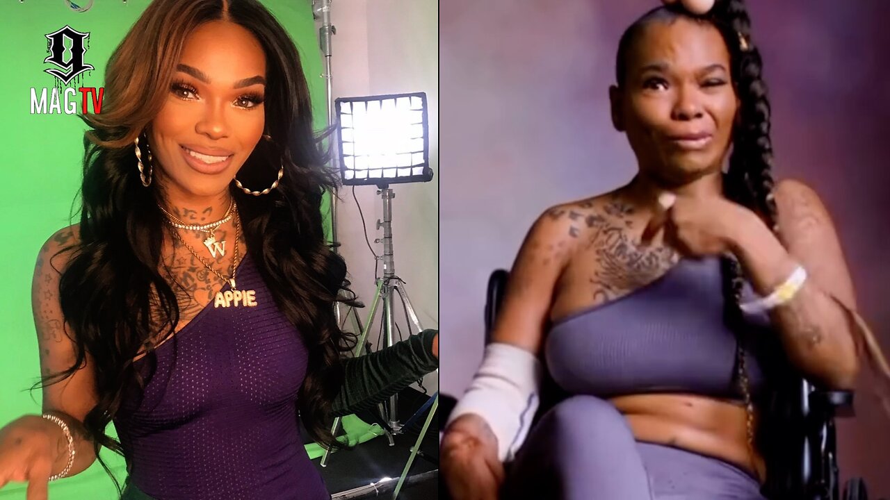 Apple Watts Responds To Backlash After Interview Detailing Her Car Accident! 🙏🏾