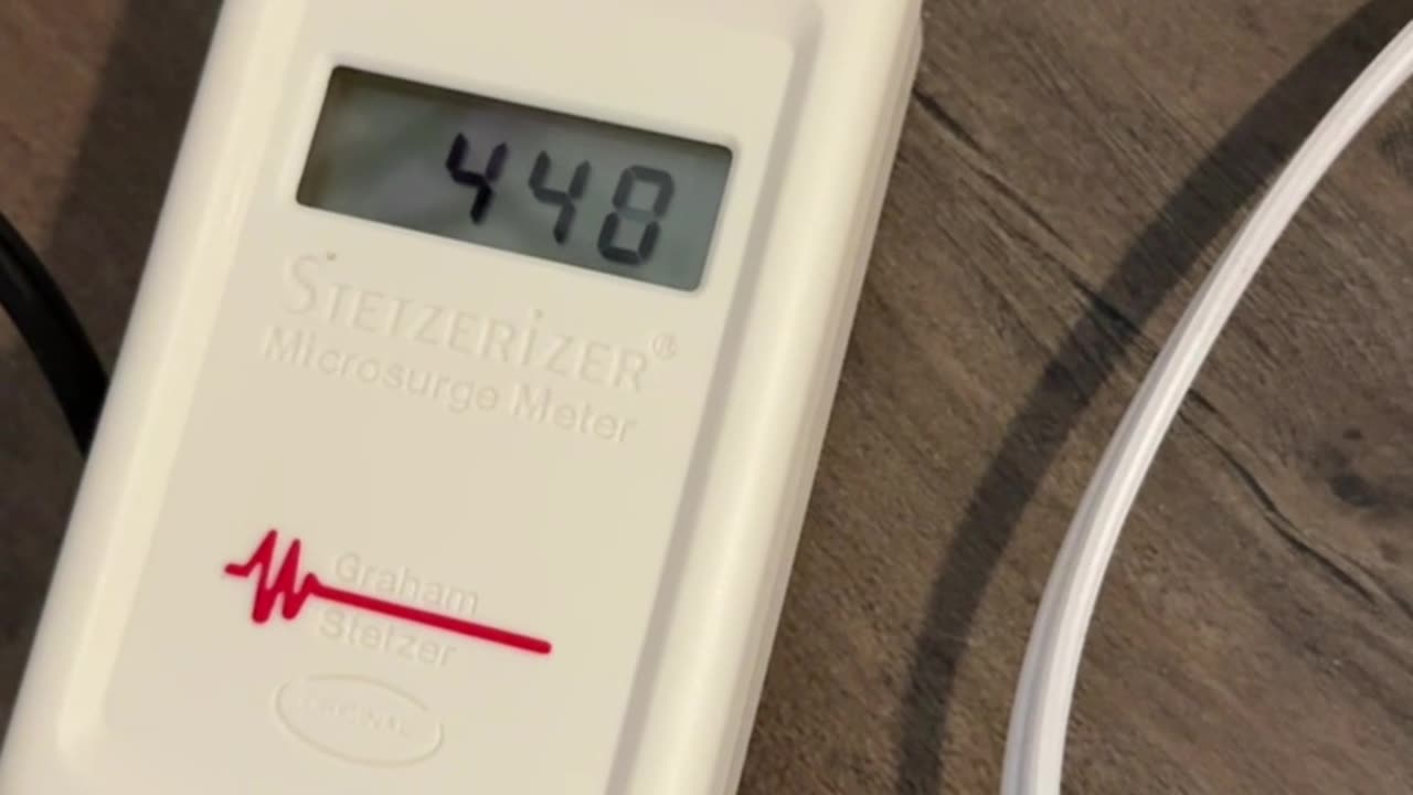 Xbox Causes Dirty Electricity