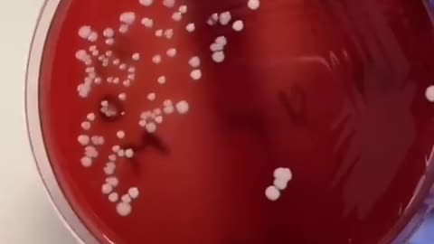 Extraction of microbe from mobile phone