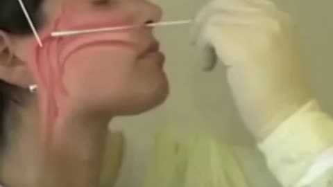 Nanobots found on the Swab Test?