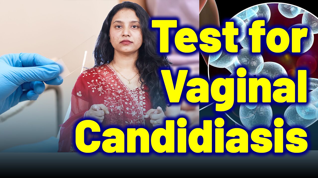 Mandatory Test for Vaginal Candidiasis| Treatment Medicine Surgery | Gynaecology Women | Homeopathy