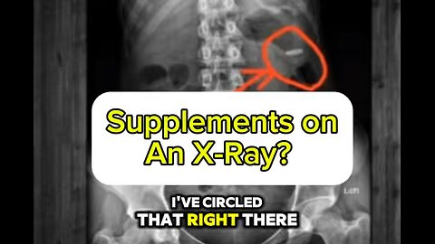 Supplements are an x-ray? 🤔