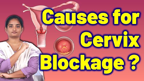 Causes For Vagina Cervix Blockage? Birth Canal Problems Infertility Treatment Cure Medicine Surgery