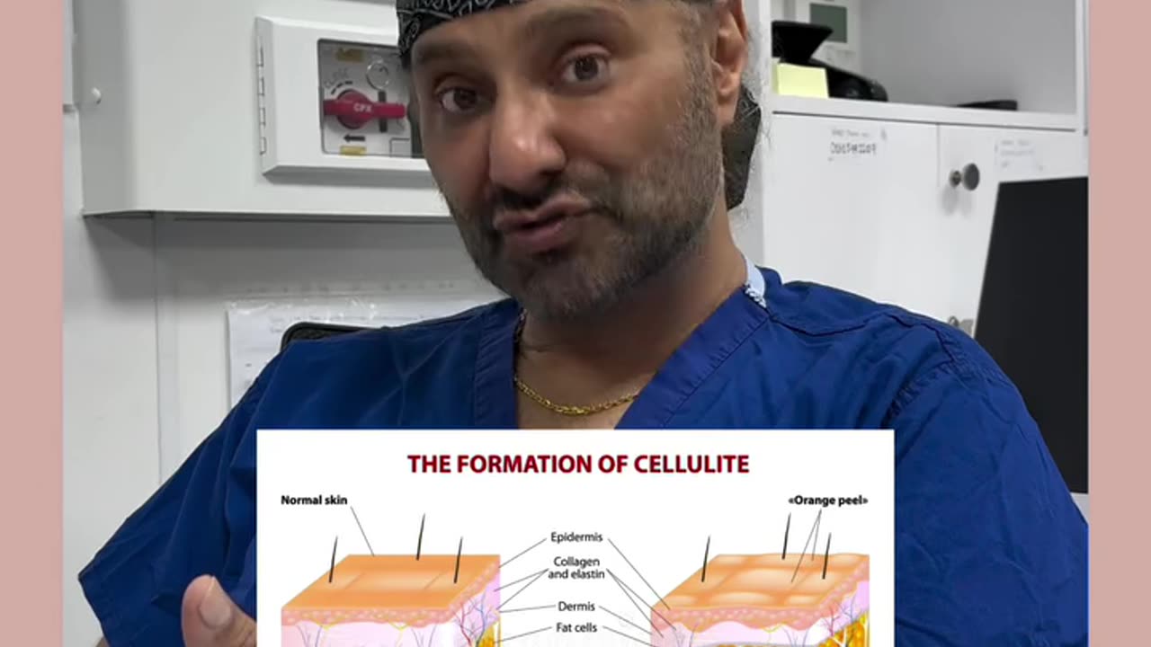 Will loose skin remain after Liposuction? Dr Kam Singh Answers!