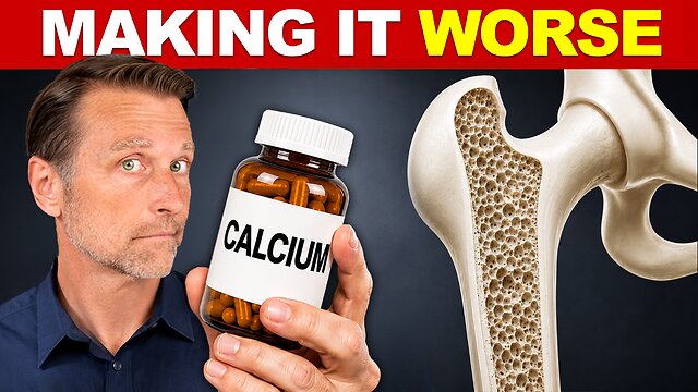 Osteoporosis Isn't a Calcium Deficiency (Doctors Get This Wrong) thumbnail