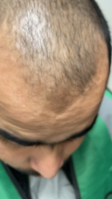 My New hair is going?