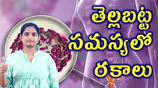 తెల్లబట్ట సమస్యలో రకాలు Types Of Leucorrhea White Dicharge Homeopathy Treatment Medicine Cure