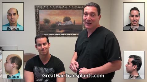 MaxHarvest™ Hair Restoration: Aly’s Journey with Dr. Brett Bolton