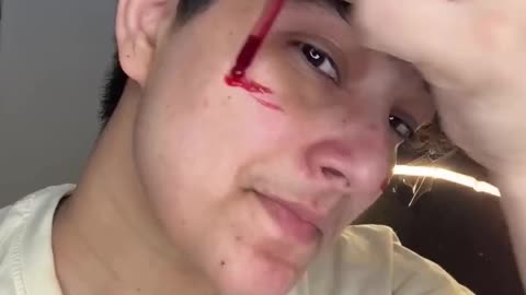 I made this serum for detan and glowing serum this winter using 3 ingredients in 10