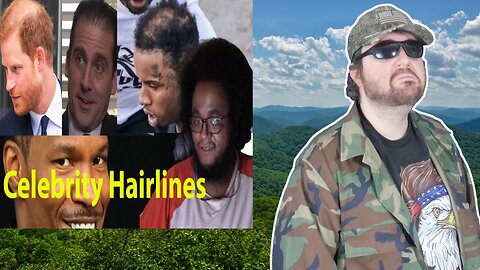 Celebrity Hairlines That Must Be Stopped (TSXD) - Reaction! (BBT)