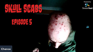 Skull Scabs Episode 5