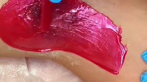 Underarm Waxing in Florida Using Sexy Smooth Cherry Desire Hard Wax by @estheglowspa