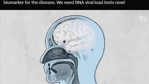 Covid is Eating People's Brains