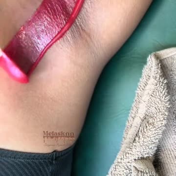 @bestofmishale Underarm Waxing with Sexy Smooth Cherry Desire Scented Hard Wax | Waxing Tutorial