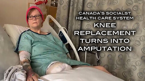 Canada's Socialist Health Care System: Knee Replacement Turns Into Amputation