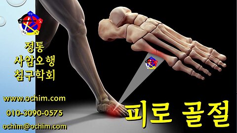 피로 골절 원인과 치료 - 사암오행침, 사암침법, 오행침, 정통사암침