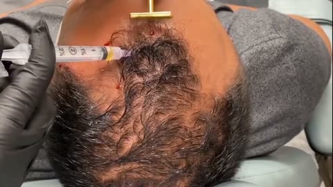 Breakthrough Inventions of 2025 – Cancer Cure, Tooth Regrowth & Hair Reversal!"